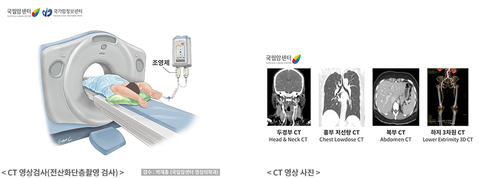 CT 검사 촬영이란